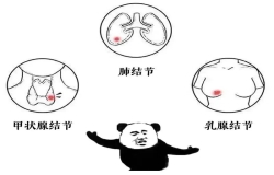 體檢查出結(jié)節(jié)，真的會癌變嗎？別慌，這樣處理就對了！